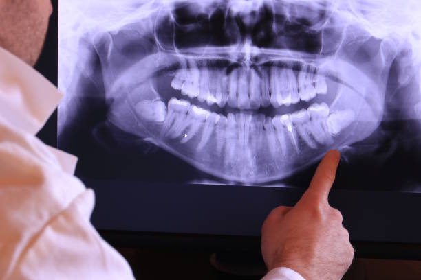 Best Emergency Dental Care for Broken or Chipped Teeth in South El Monte, CA